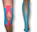 Kinesiotaping